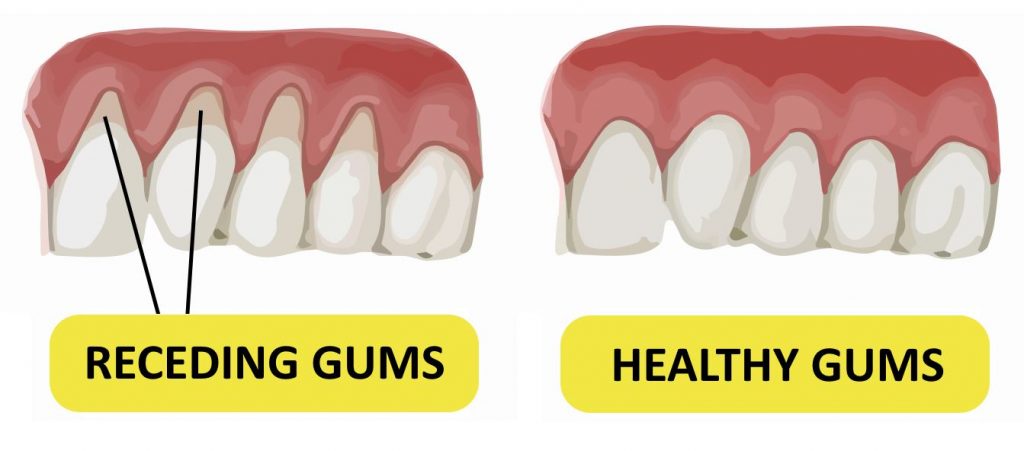 What Is Pyria? How Can It Be treated?